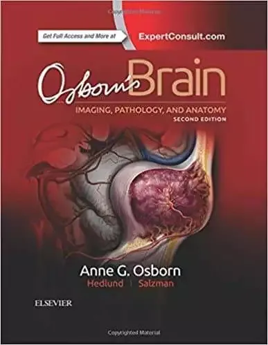 osborbs brain imaging pathology and anatomy 2e pdf