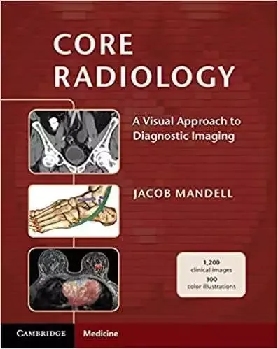 Core Radiology: A Visual Approach to Diagnostic Imaging (1st Edition) - eBooks
