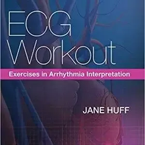 ECG Workout: Exercises in Arrhythmia Interpretation (7th Edition)- eBook