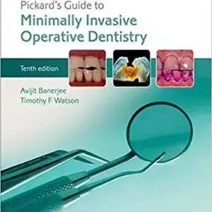 Pickard's Guide to Minimally Invasive Operative Dentistry (10th Edition) - eBook
