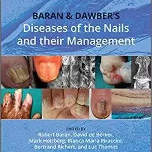 Baran and Dawber's Diseases of the Nails and their Management (5th Edition) - eBook